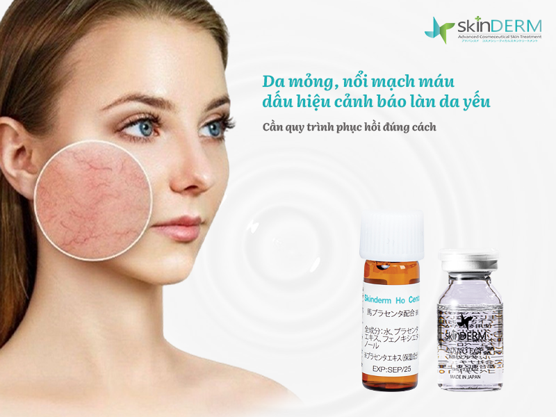 Da mỏng nổi mao mạch điều trị thế nào