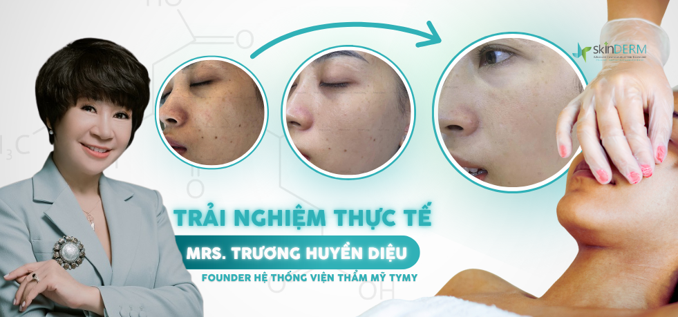 Trải nghiệm khách hàng