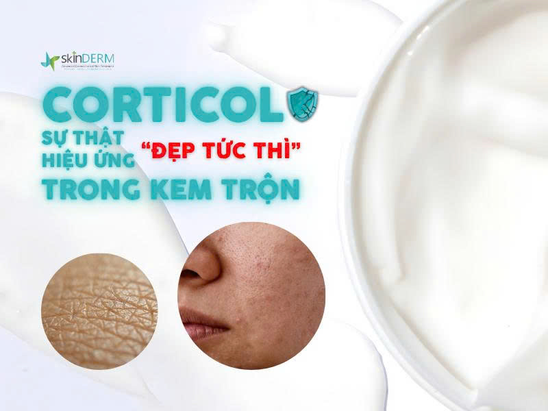 Sự thật đẹp tức thì của Corticol