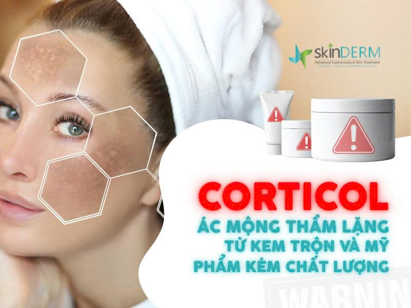 Da nhiễm Corticol
