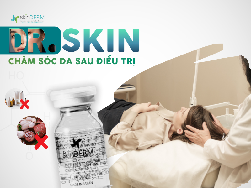 Chăm sóc sau điều trị